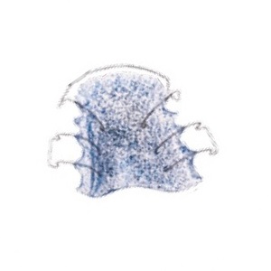 Dentaurum Orthocryl Disco glitter, blå 50 gr